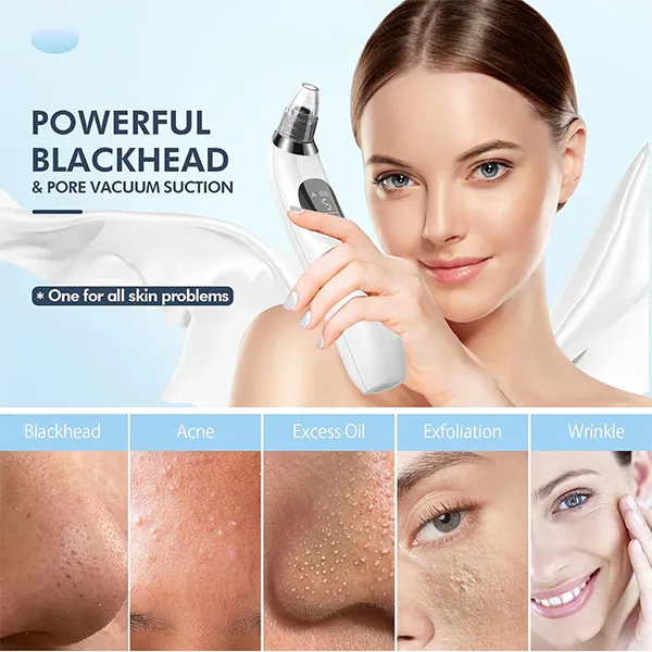 BlaRevia Blackhead Removers